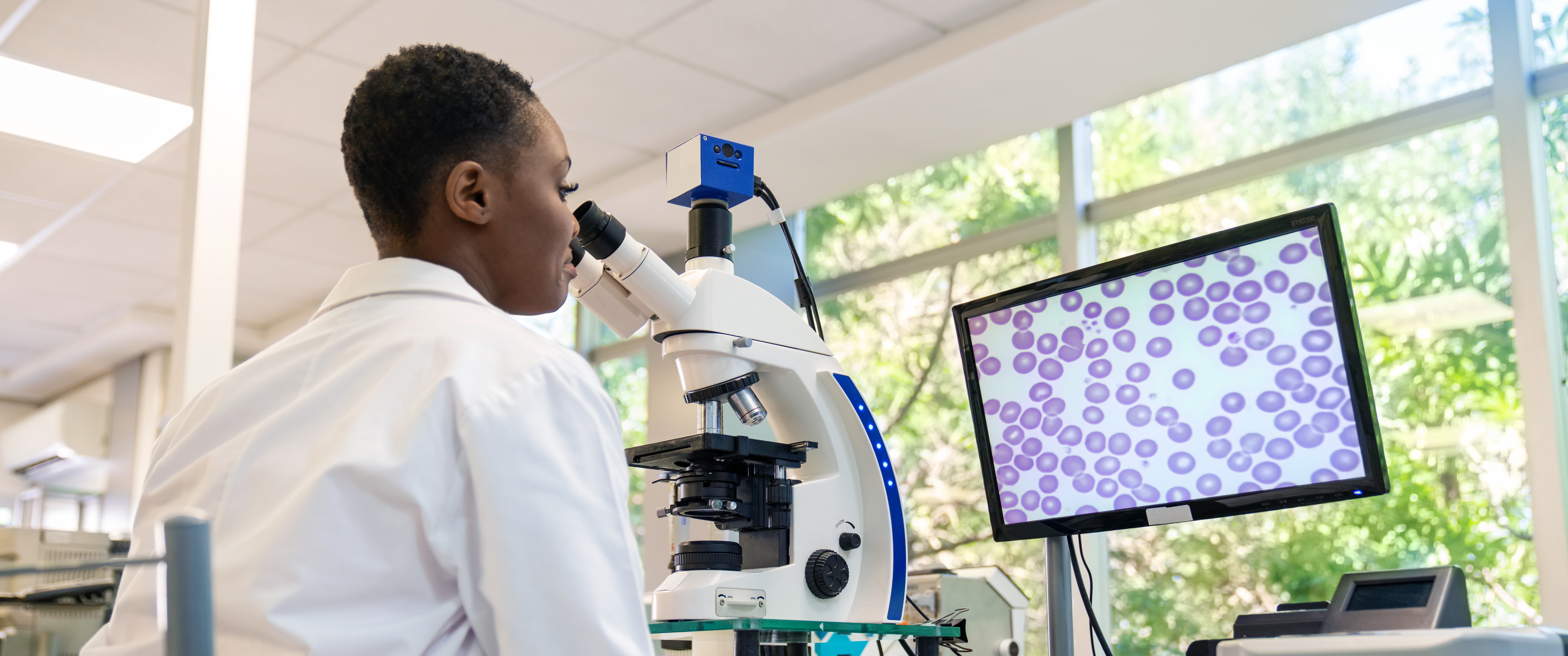 Researcher in lab coat looking at cells through microscope while image is displayed on monitor