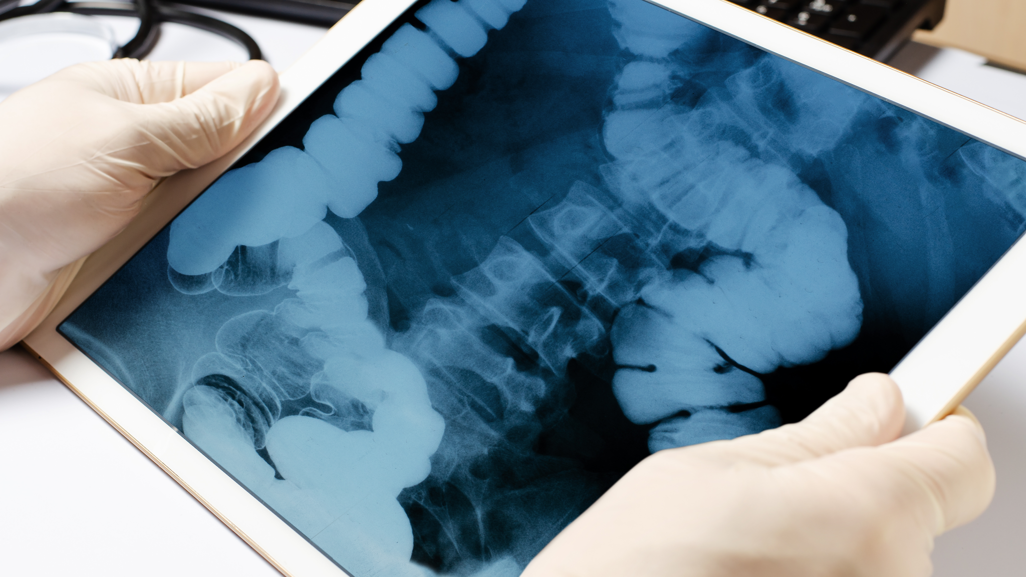 X-ray image of the intestine in the tablet. The hands of the doctor close-up. 