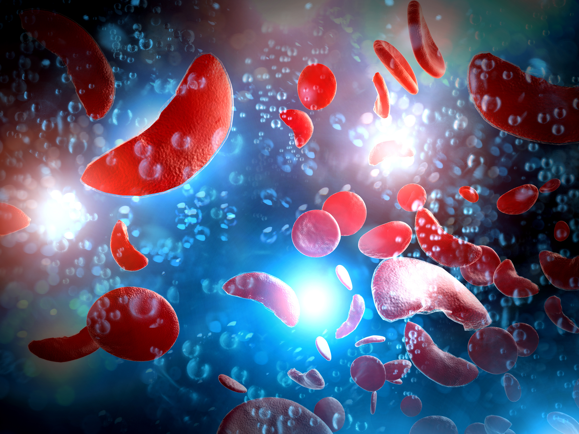 Sickle cell anemia disease (SCD) blood cells 3D illustration