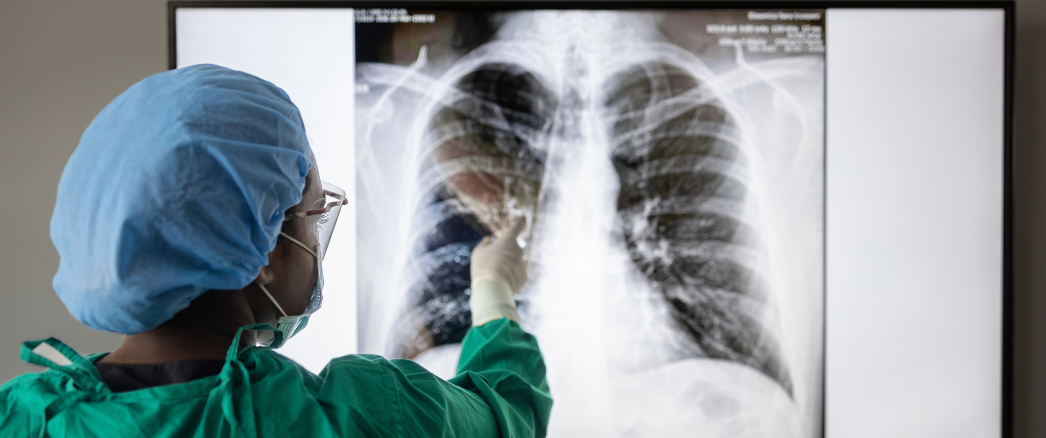 Provider reading a scan of lungs