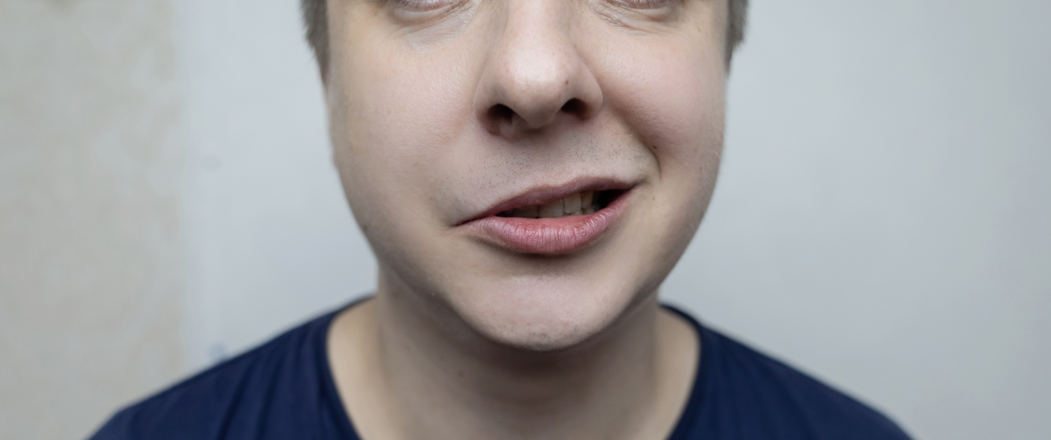 Close-up of a person showing facial asymmetry