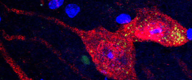 Two brightly stained colorful images of mouse brain cells. The left image shows many yellow spots in the cytoplasm