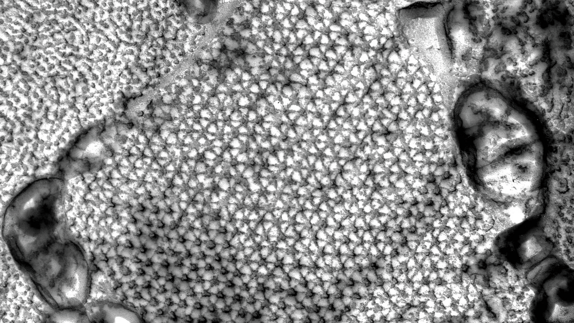 A black and white image from an electron microscope shows an orderly six-point micro-grid pattern in organic tissue.