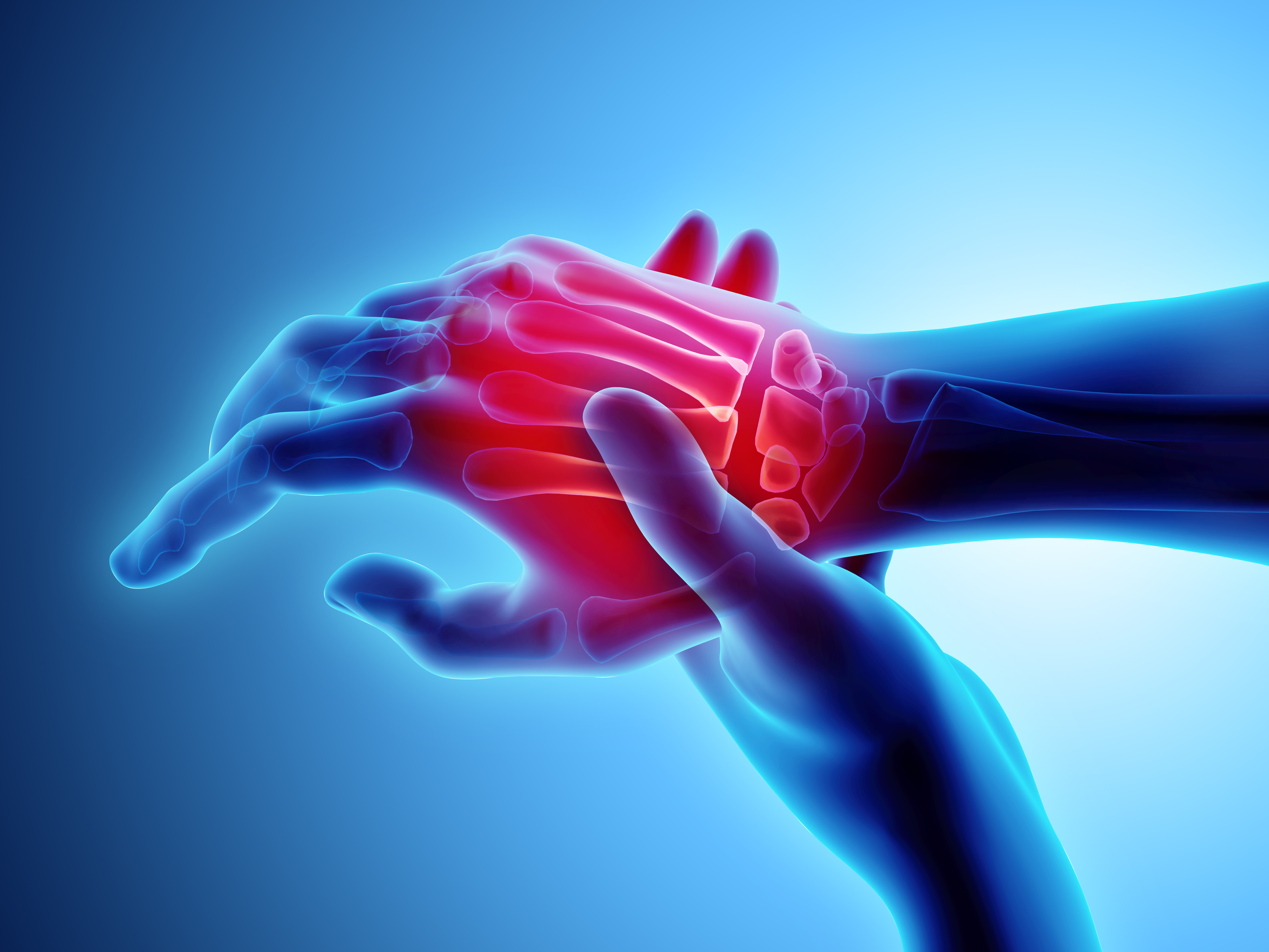 3D illustration of hand and wrist pain on skeleton xray