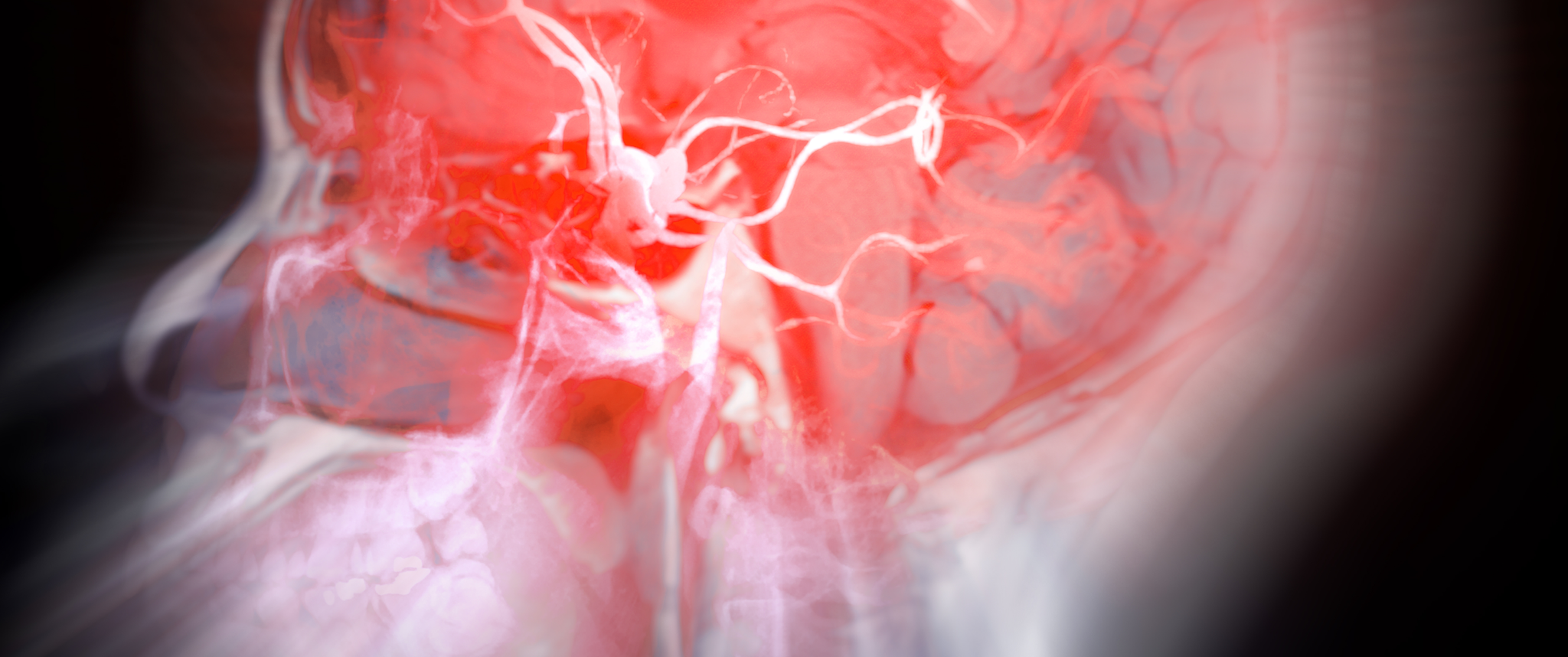 An illustration of the brain illuminated to show the blood vessels