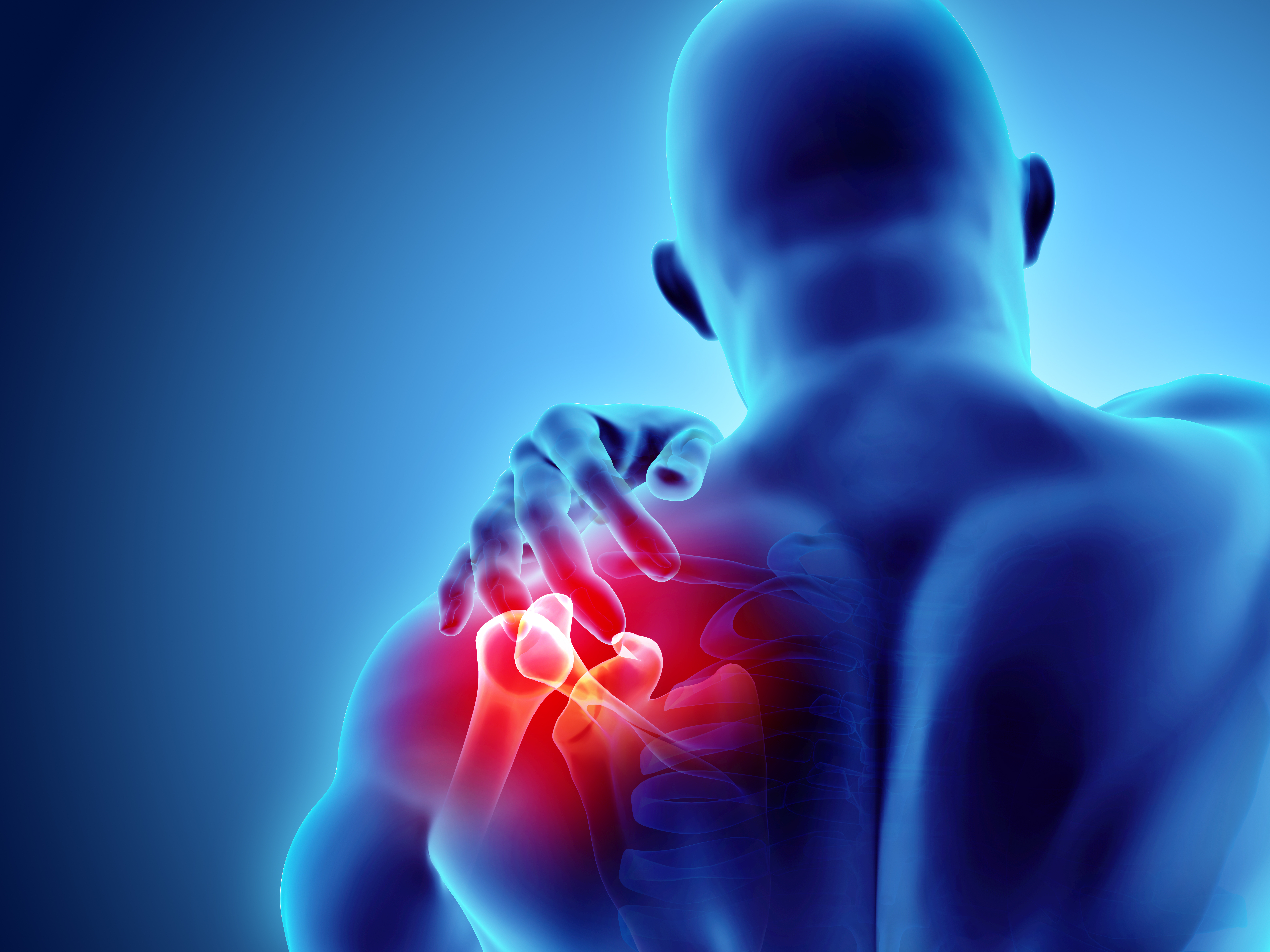 3D illustration of shoulder pain on skeleton xray
