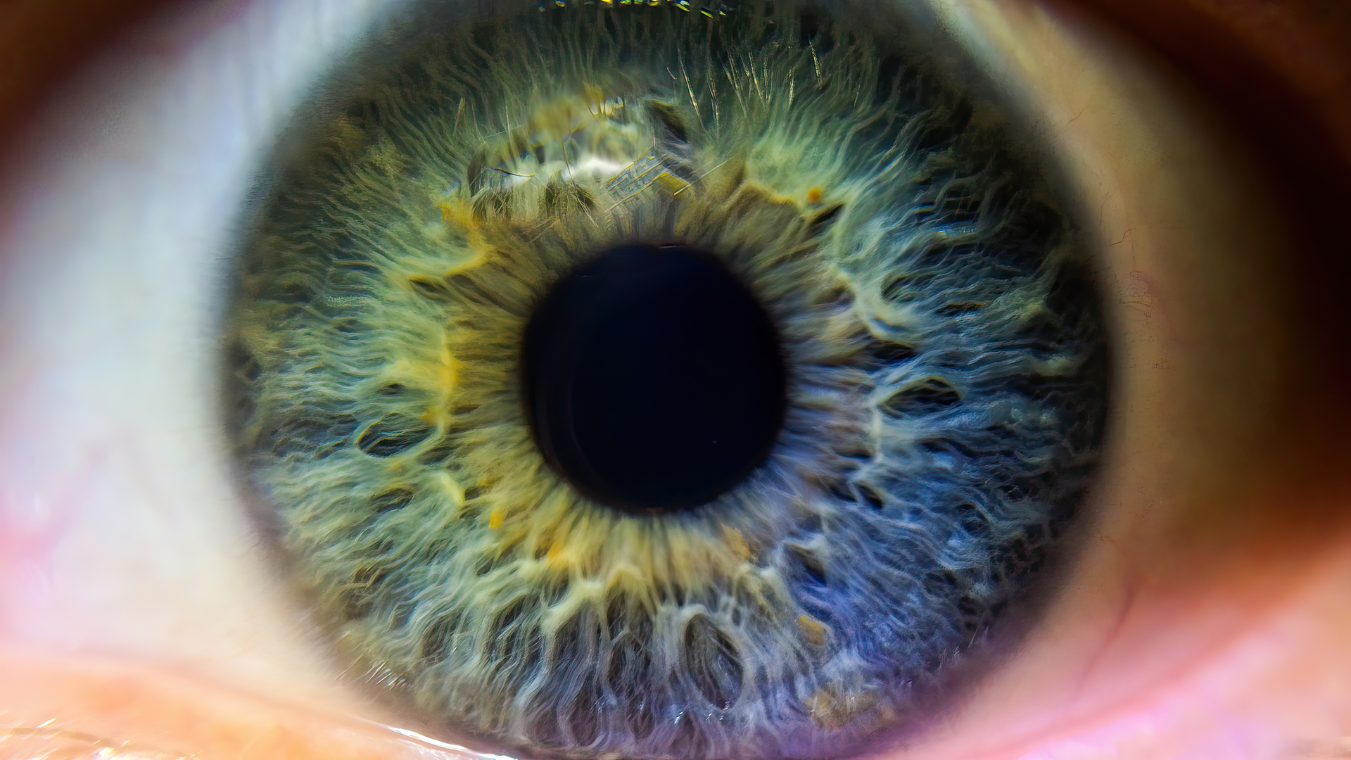 Close-up photograph of the retina of an eye.