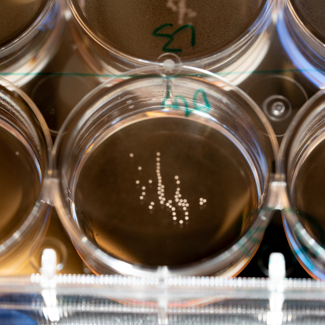 Round dishes, each containing tiny white spheres that are brain organoids in a fluid medium