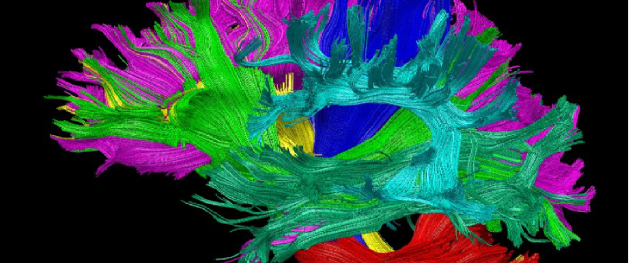 A colorful scientific image of the brain with different sections and connectivity pathways colored in with different bright colors