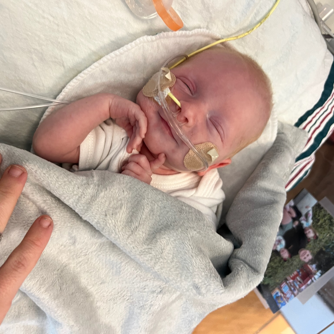 Infant KJ smiles with tubes in his nose