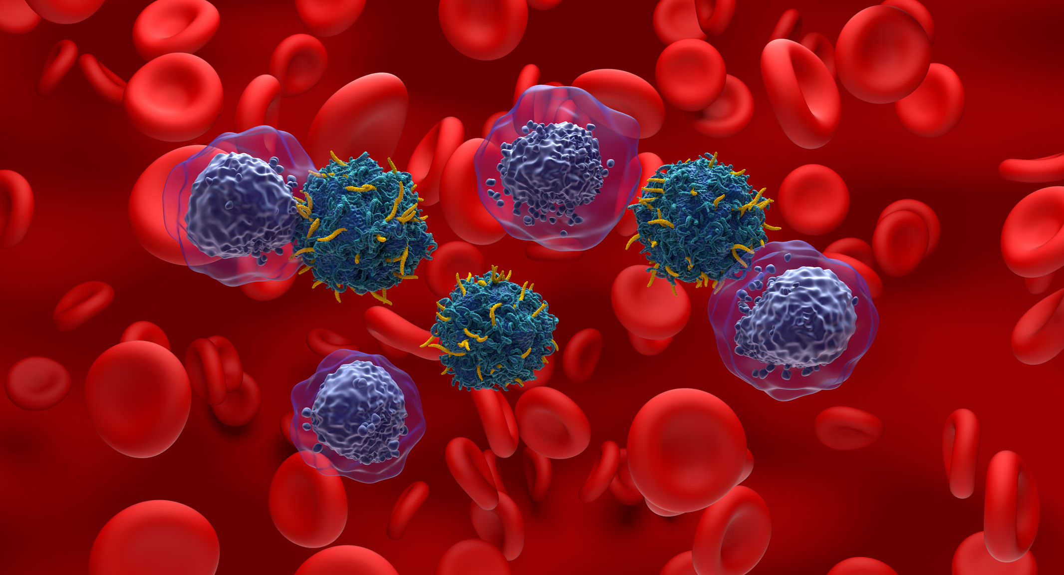 CAR T cells attacking acute myeloid leukemia cells.