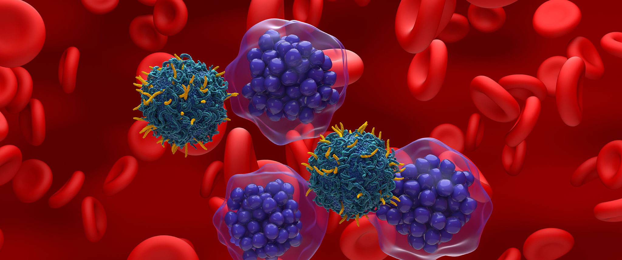 An artist's rendering of CAR T cells attacking B cell lymphoma cells.