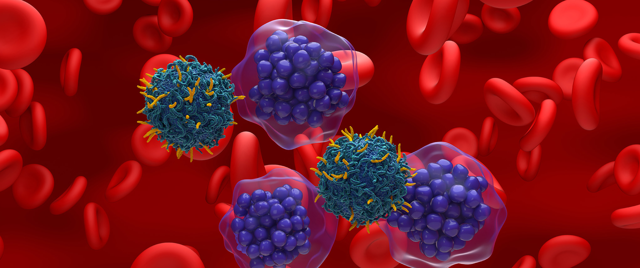 Advancements in Lymphoma Treatment Highlighted by Expert