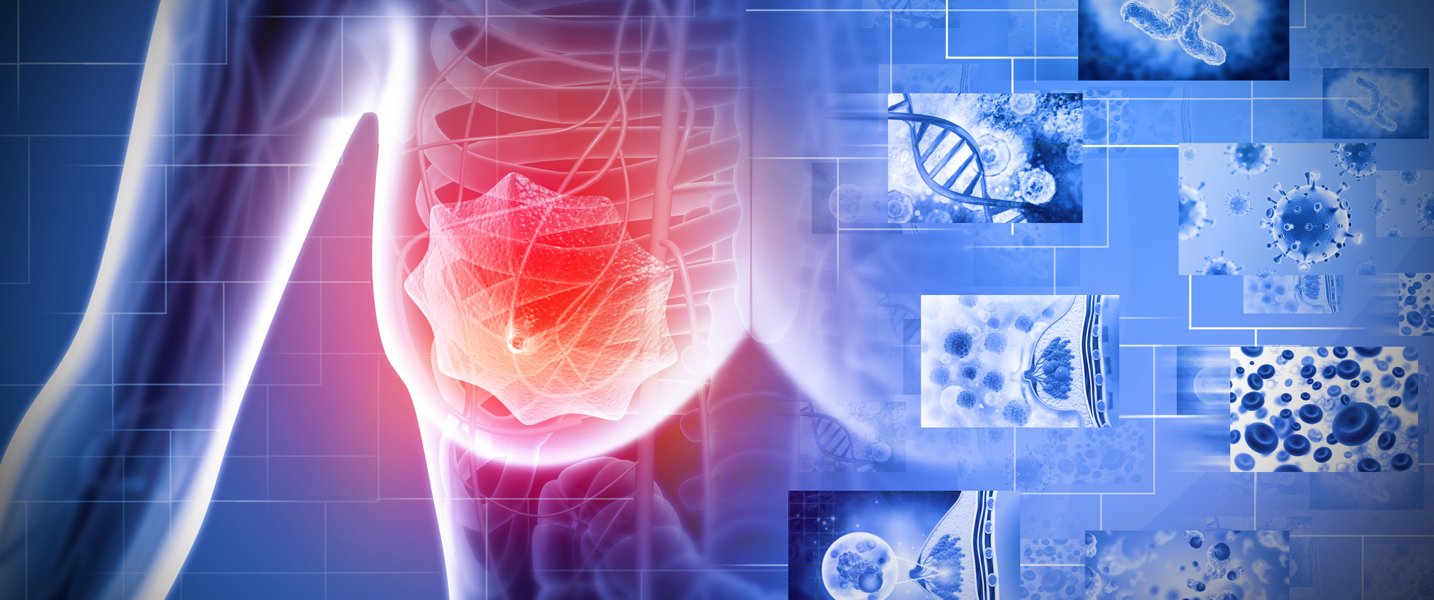 An illustration of a human skeletal figure with a shape suggesting breast cancer, surrounded by various scientific images