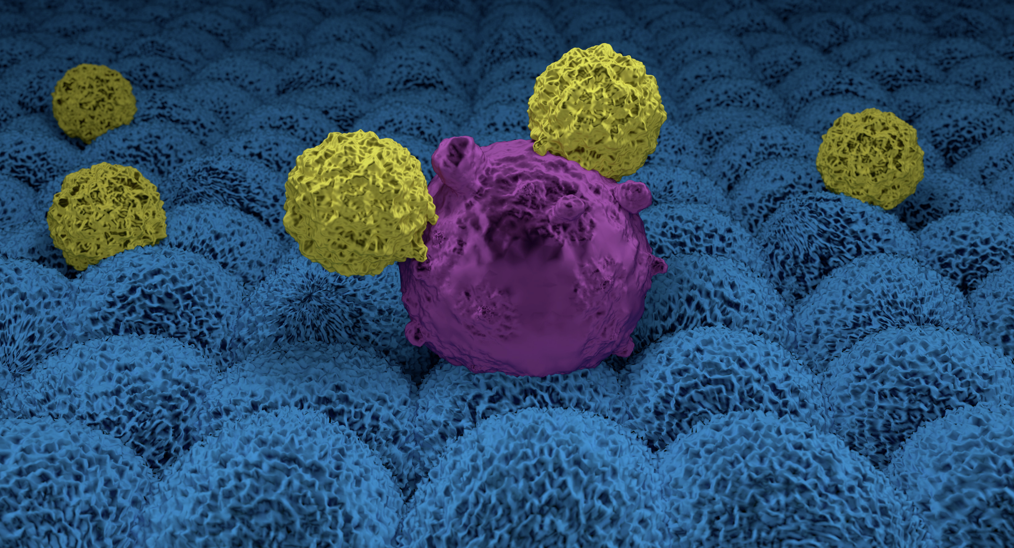 CAR T cells attacking a cancer cell