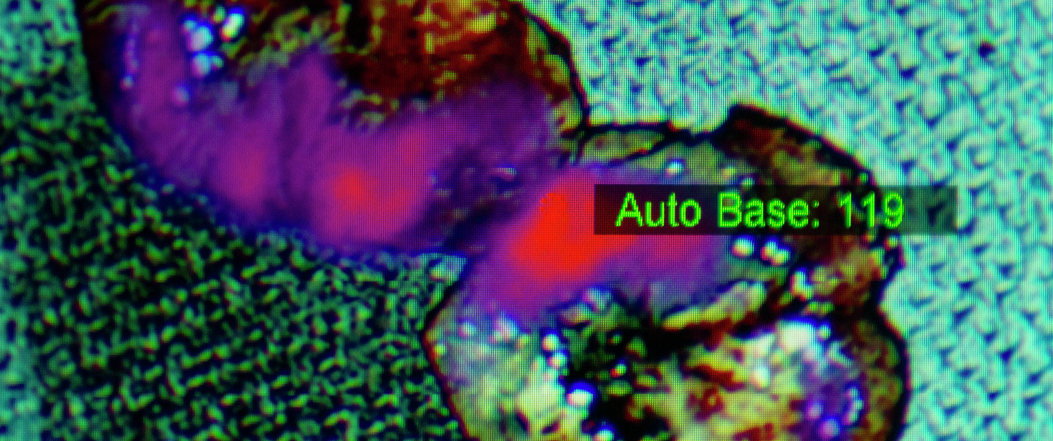 Close-up image of a monitor showing bright glowing regions within an image of tissue