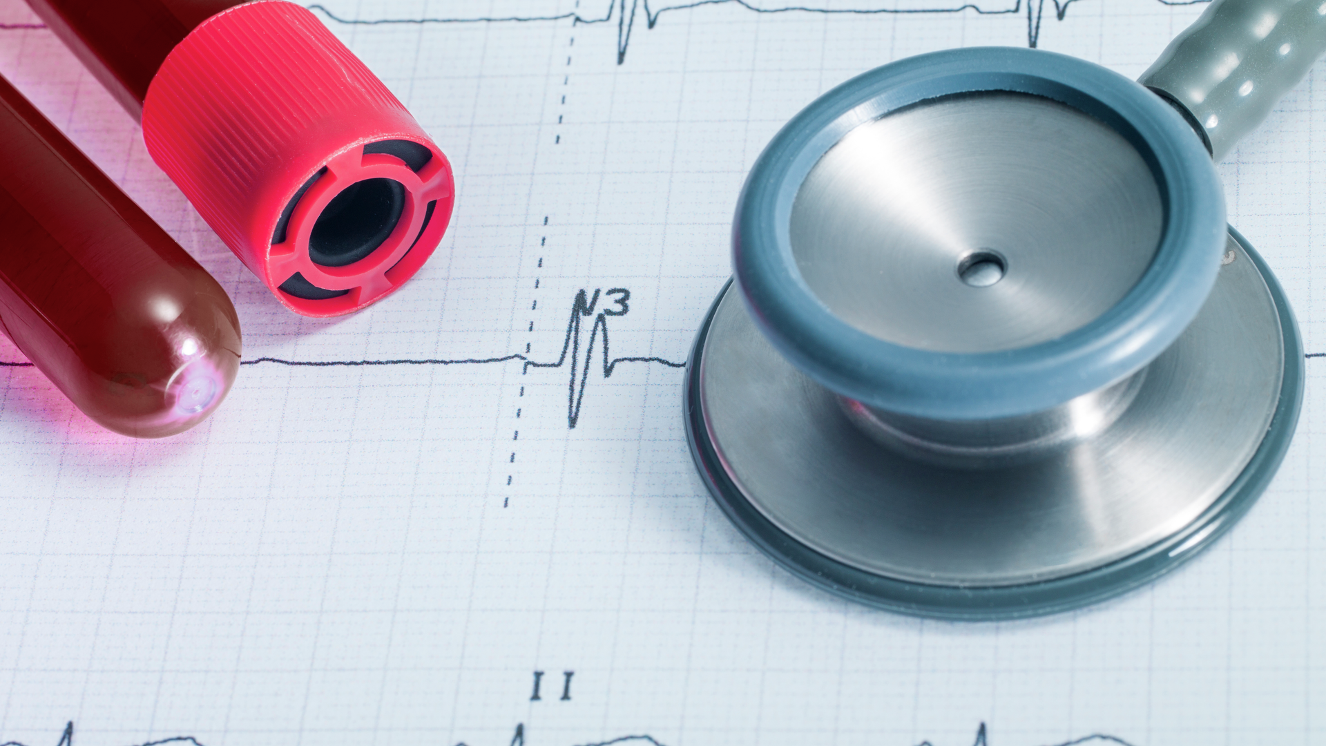 Stethoscope on EKG and blood sample test tubes