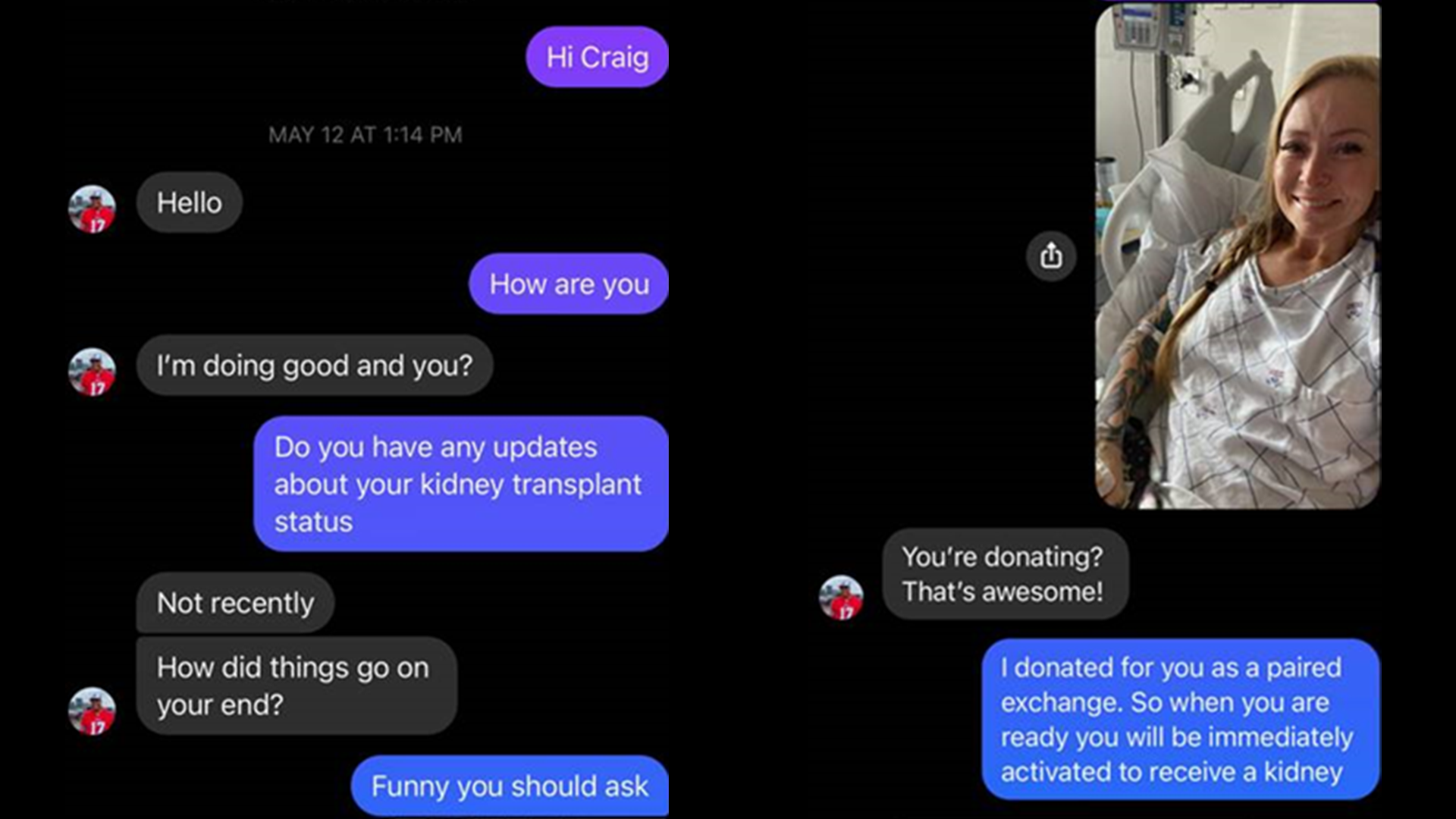 A text-message exchange in which Morgan asks about Craig's kidney, he asks back, and she responds with a selfie from the hospital