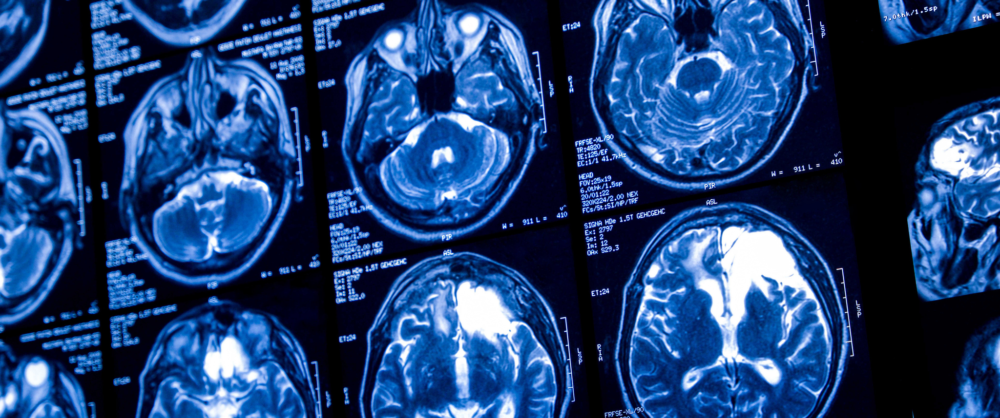 Multiple scans of a human brain
