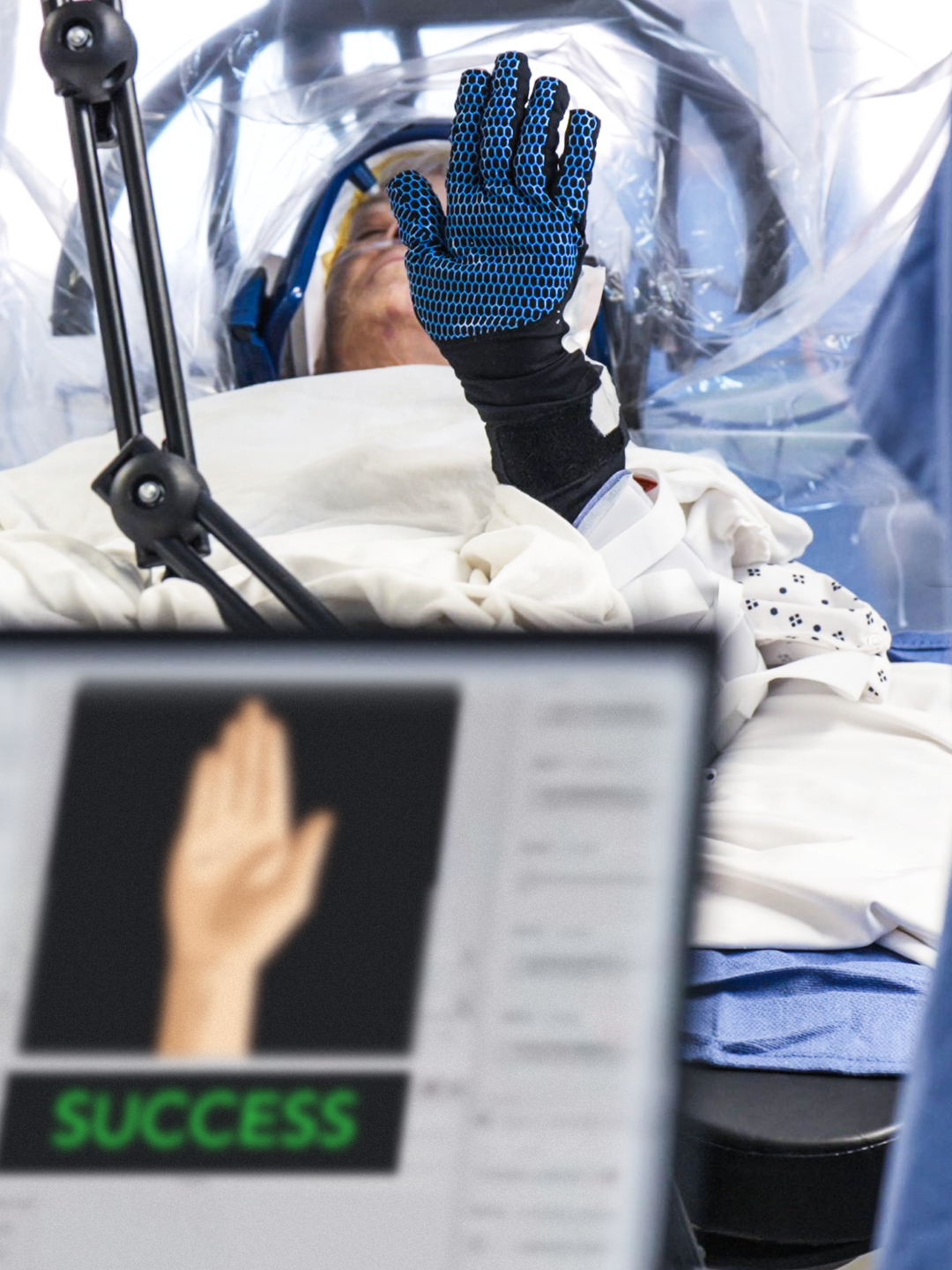 A patient on an operating table holds up a gloved hand, while a computer screen displays a graphic of a hand with the word “Success.”
