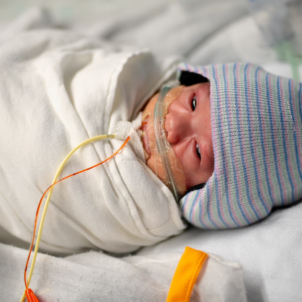 A premature infant listening to a parent’s recorded voice through the Sonura Beanie