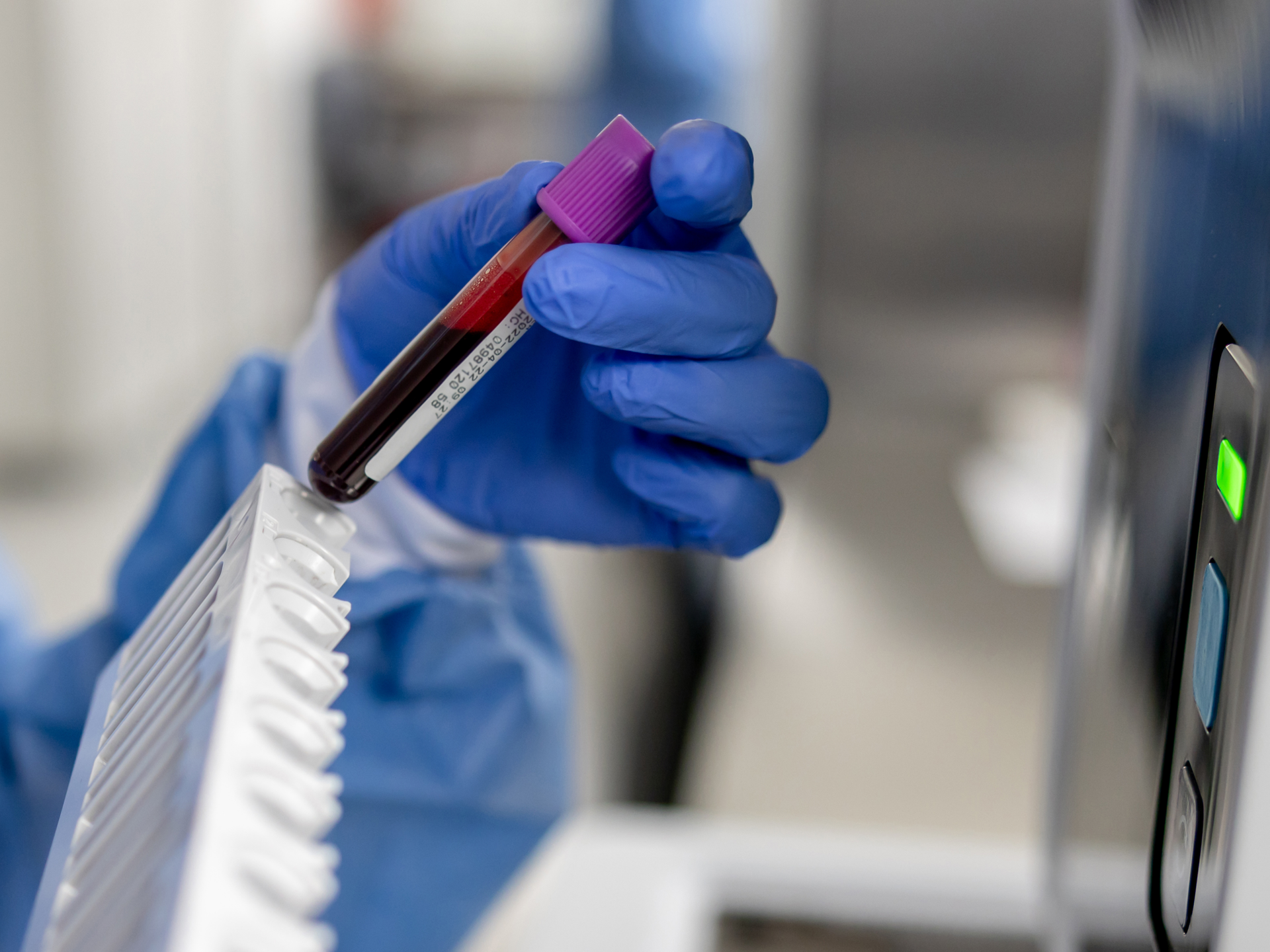Close-up on a technician analyzing blood samples at the lab and holding a test tube