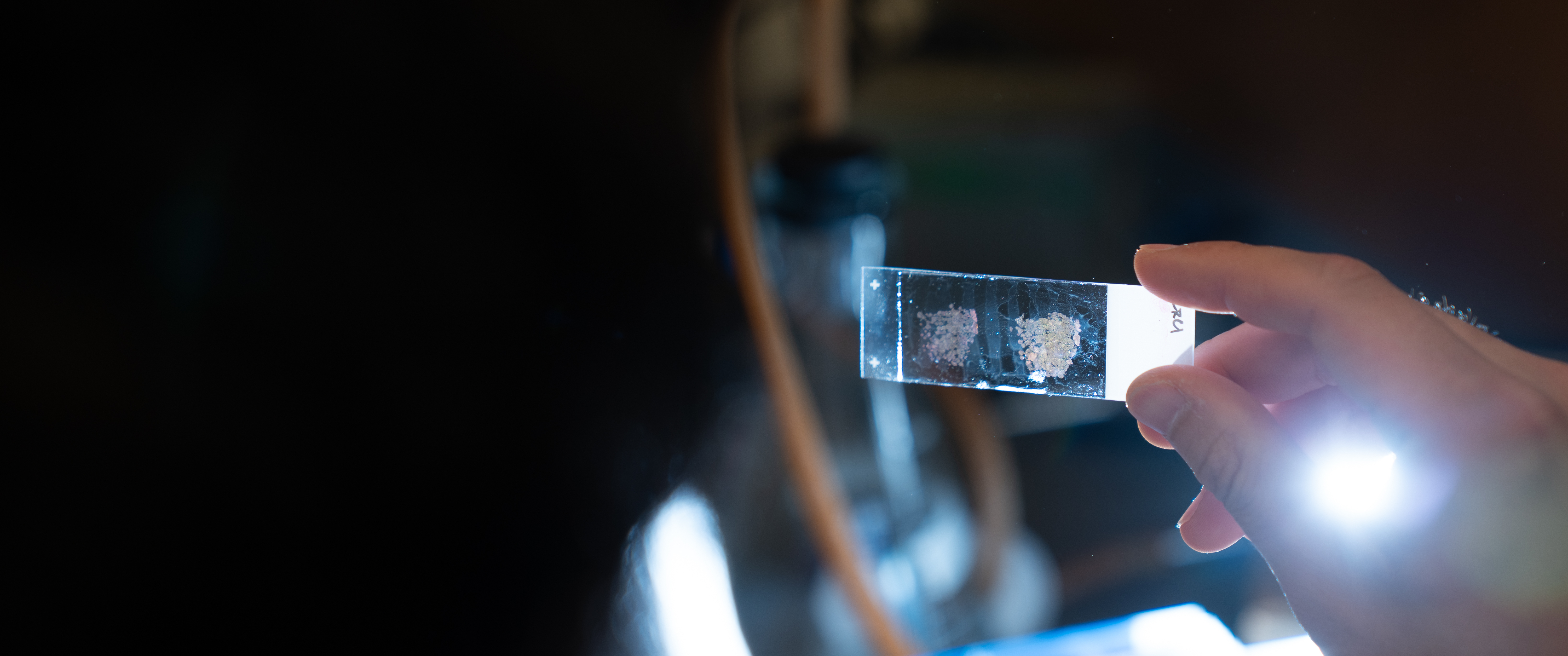 A hand holds up an illuminated glass slide for a microscope, on which clusters of pink-stained cells are visible