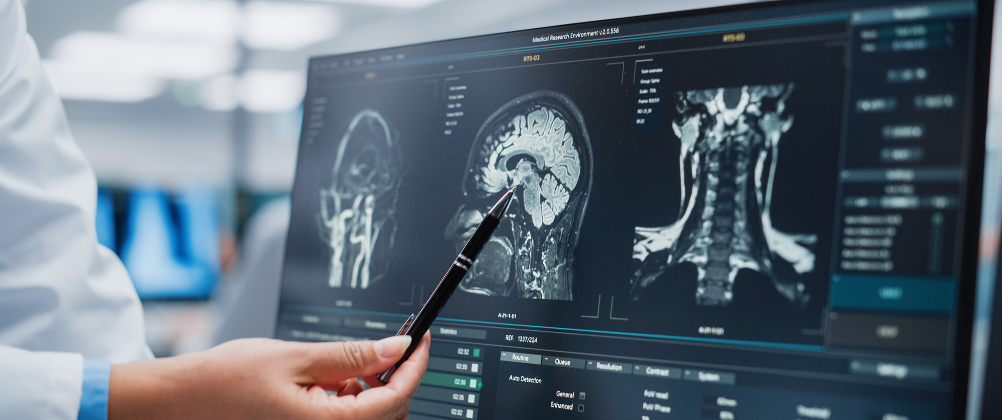 A doctor pointing at a brain scan