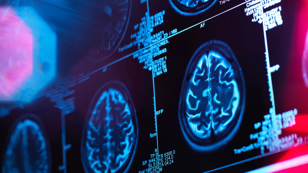 Advanced MRI dataset maps adolescent brain development | Penn Medicine