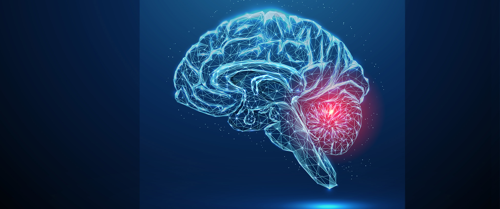 An illustration of the brain with a focus on the cerebellum and brain stem, potential locations for cavernous malformation.