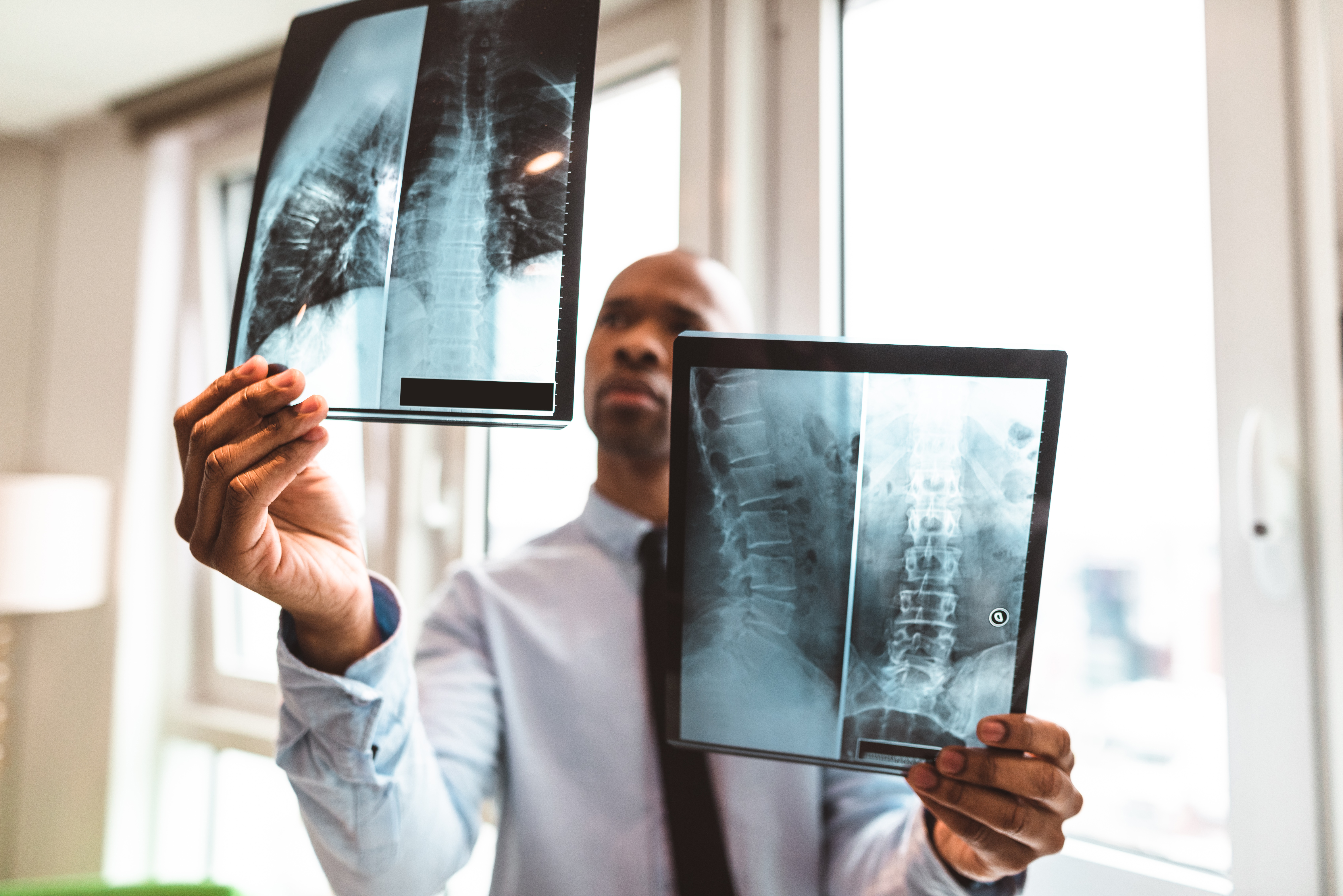 Doctor reading spine x-rays in the office 