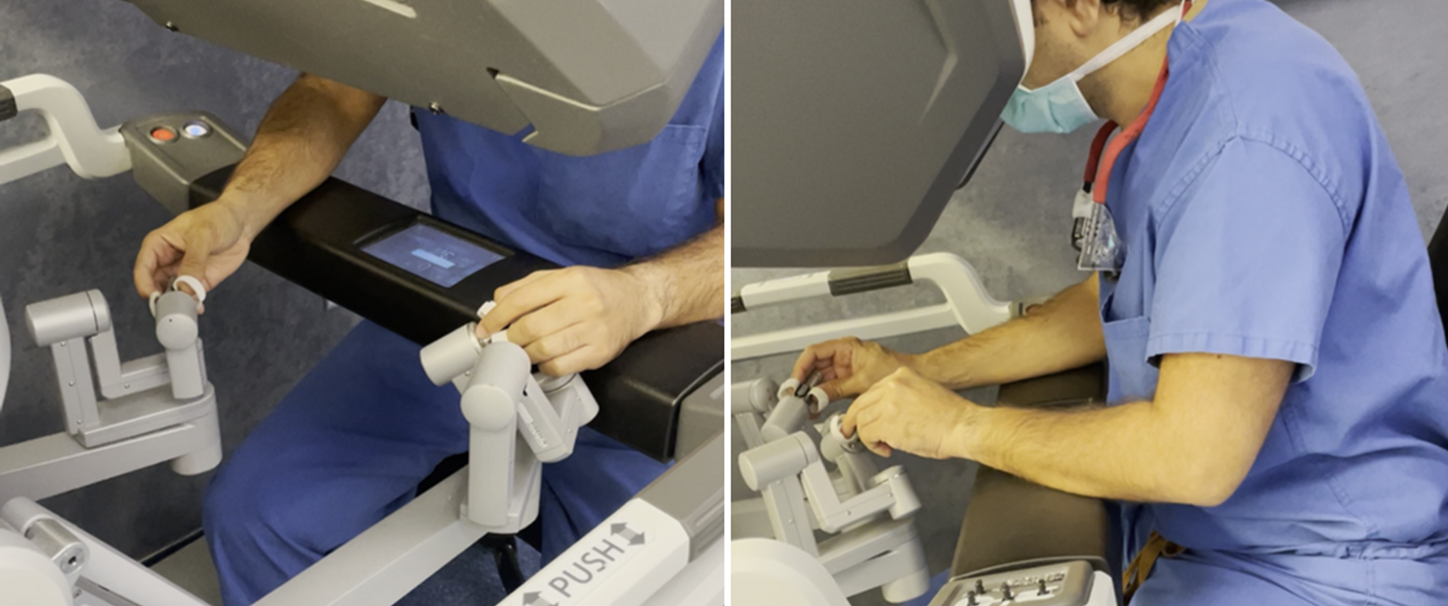Two different angles of a robotic surgery procedure. 