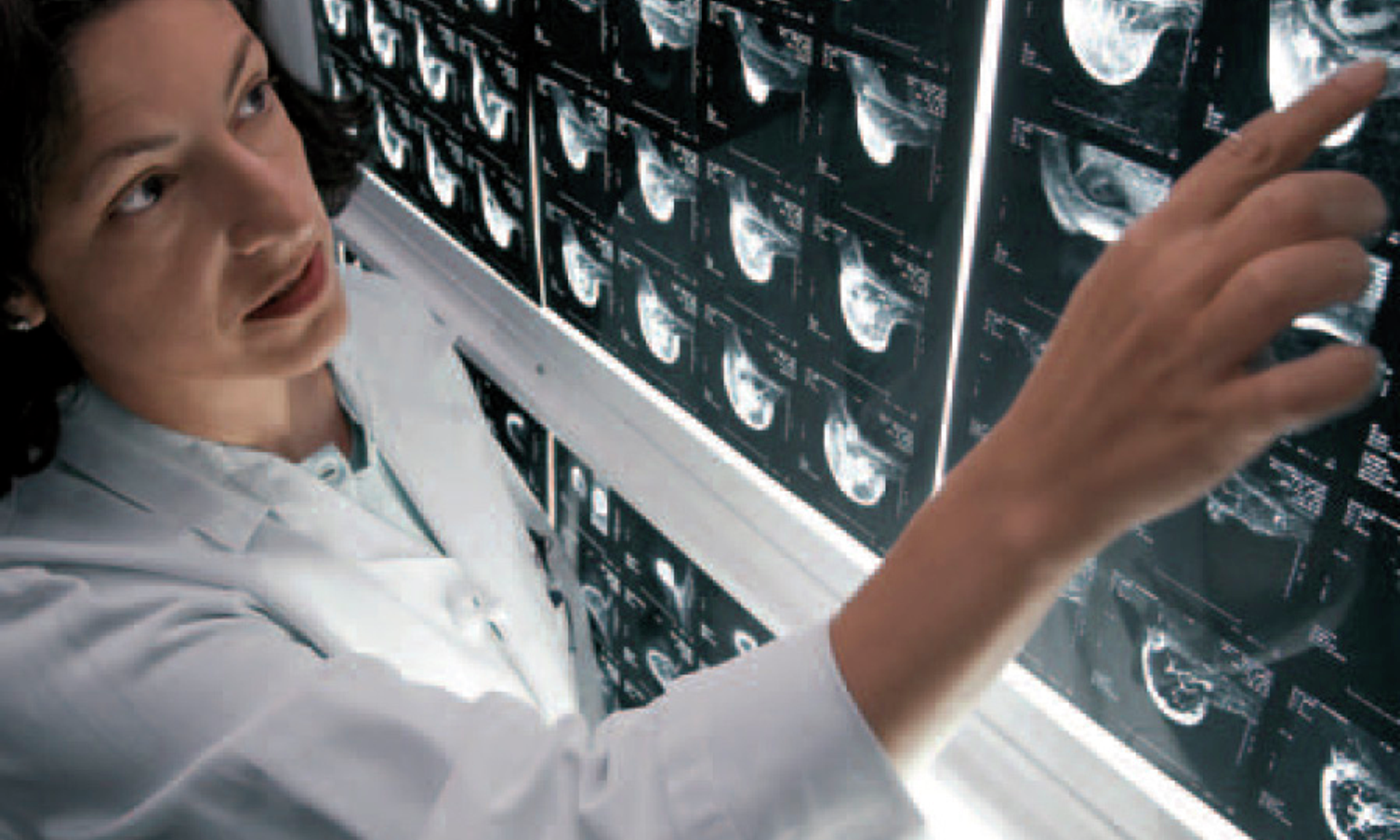 Angela DeMichele looks at medical images on film