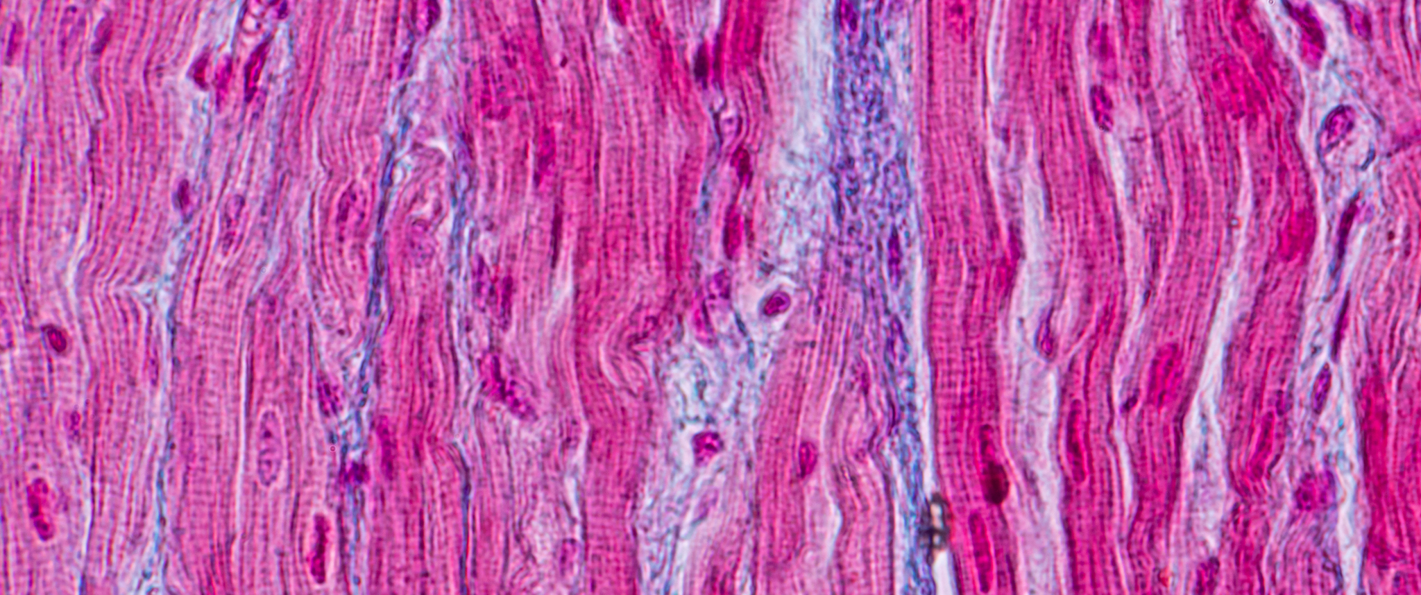 Heart muscle cells
