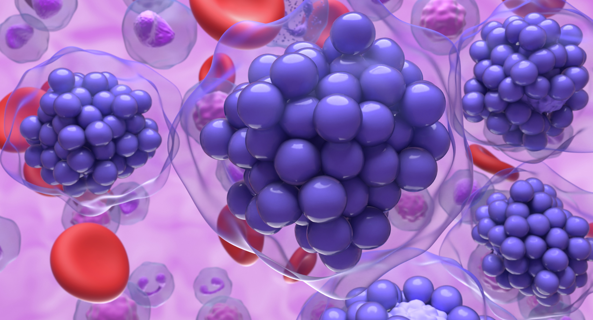 Depiction of lymphoma