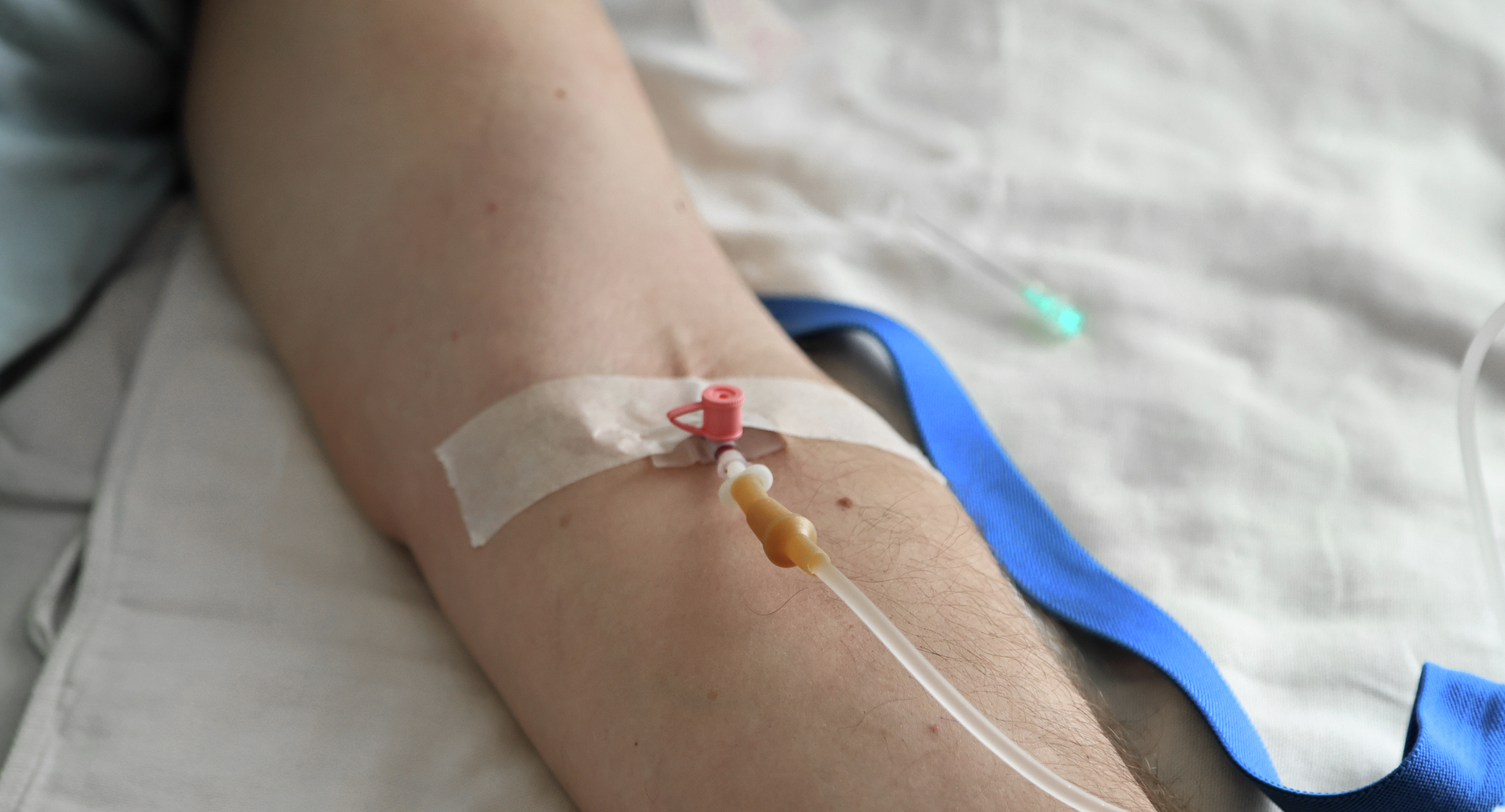 Patient receiving infusion in arm