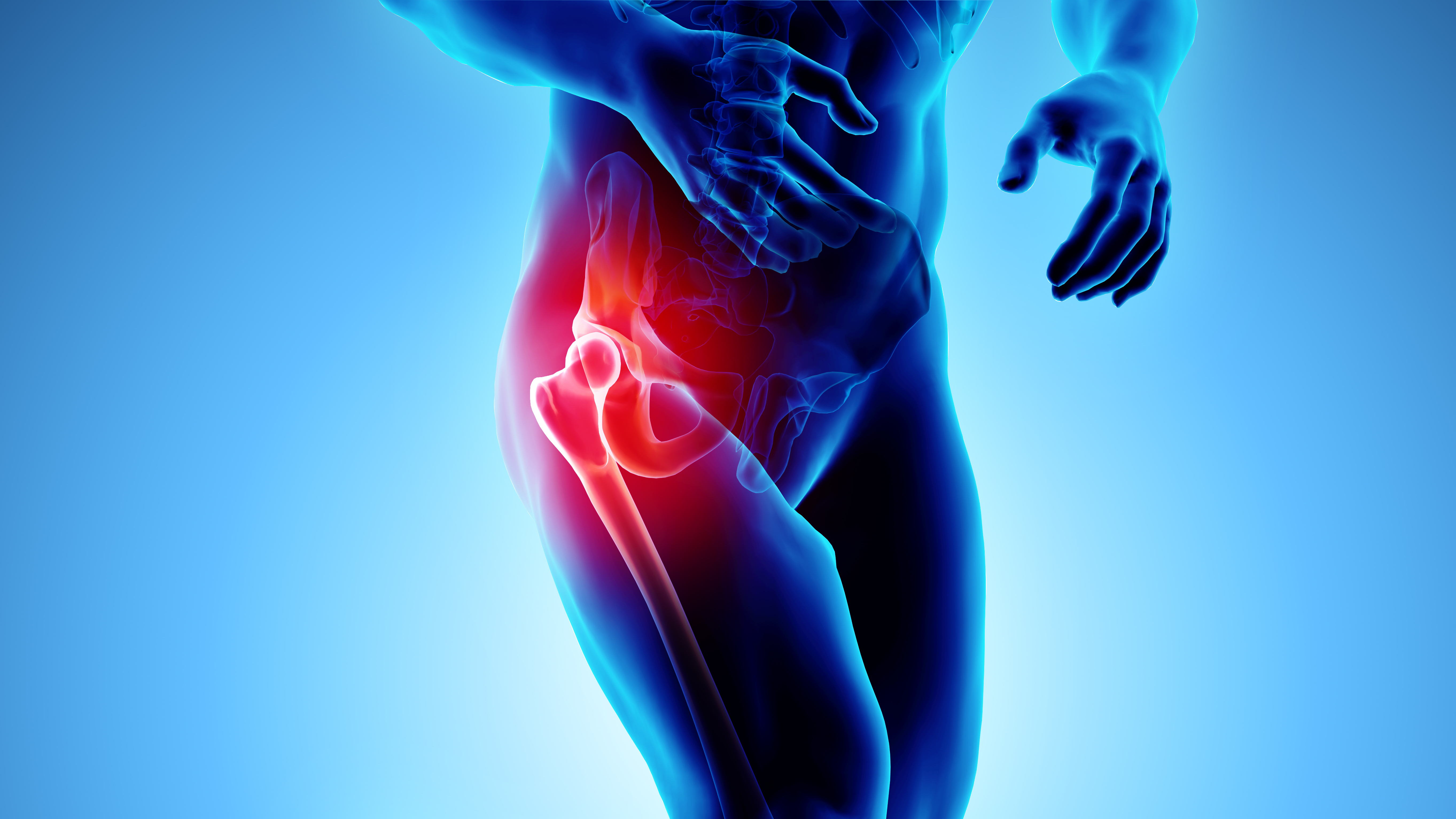 3D illustration of hip pain on skeleton xray