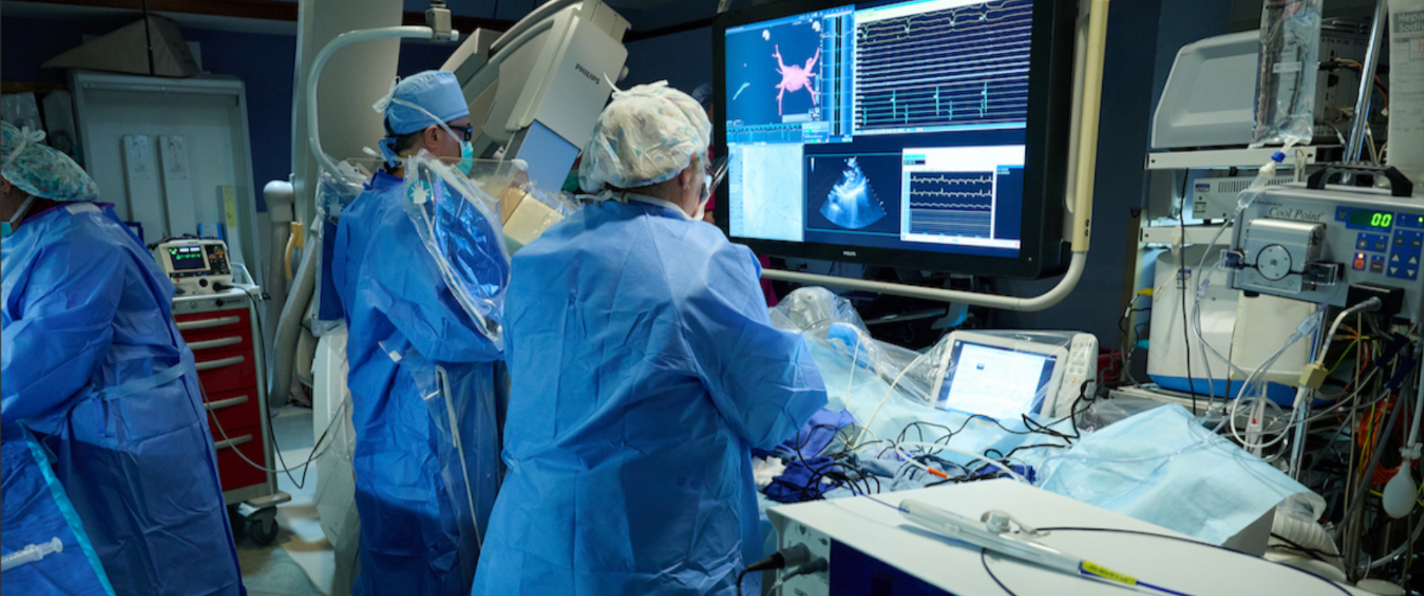 Providers preparing for a pulsed field ablation in front of a large monitor screen