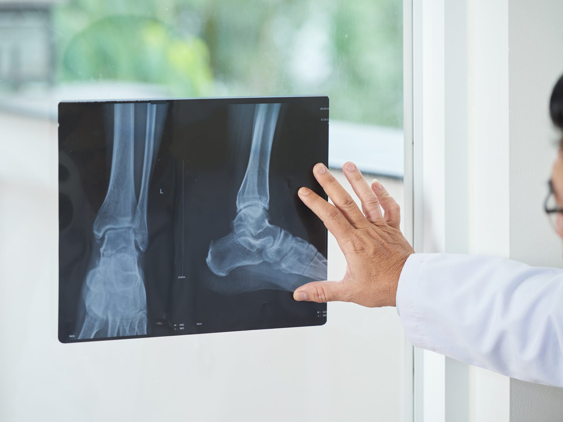 A doctor holding scans of a foot up to examine.