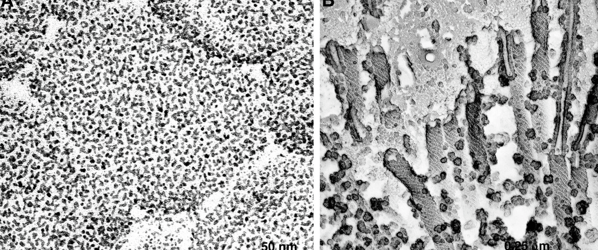 Alt: Black and white images captured by a microscope, in two panels. Left: Small black dots on a white field. Right: Finger-like tubular projections spotted with black dots