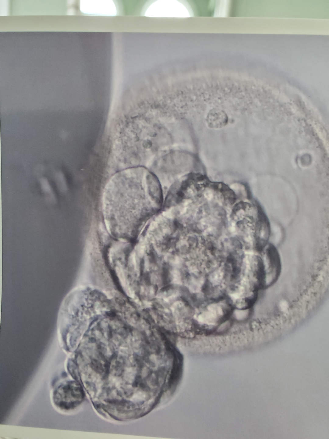  A microscopic image of embryonic cells
